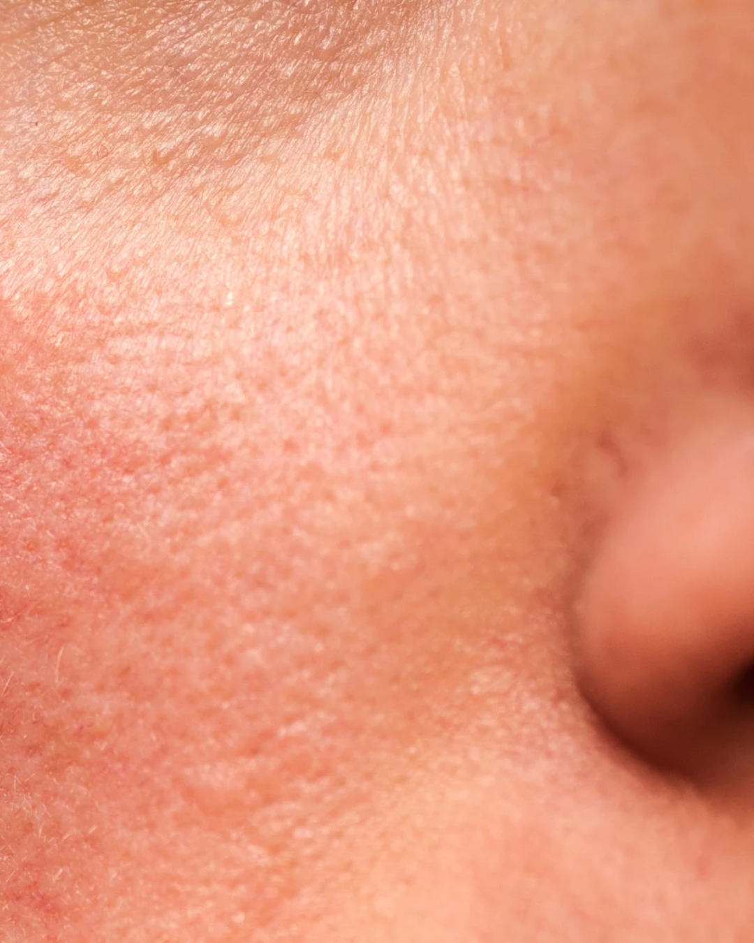 Redness / Inflammation