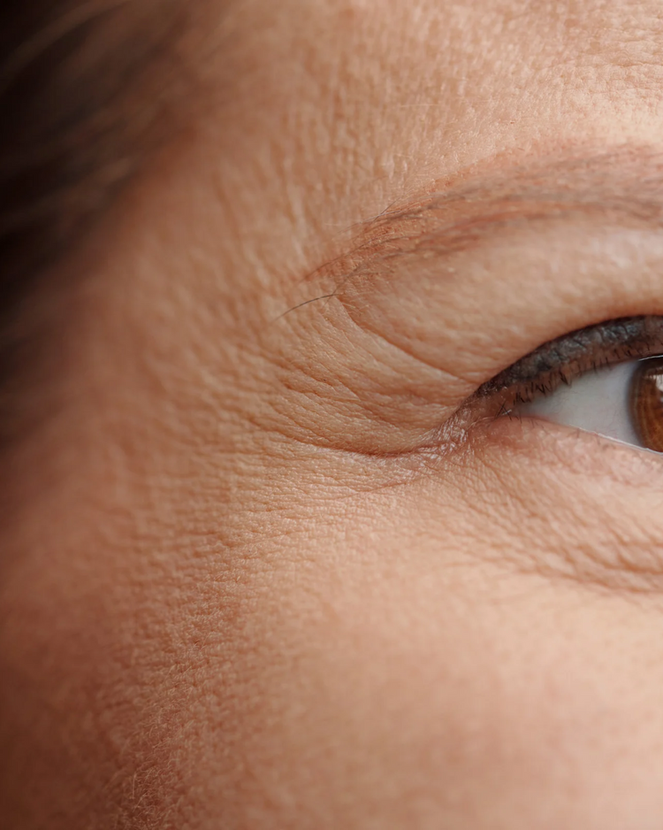 Anti-Aging