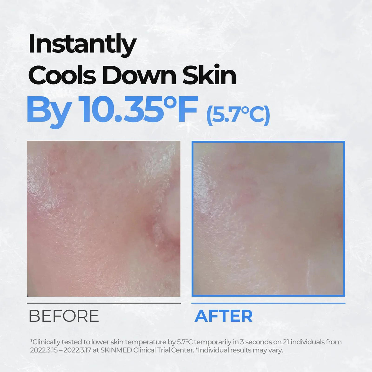 [CellFusionC] Post Alpha Cooling Pad - 70 Pads_MX